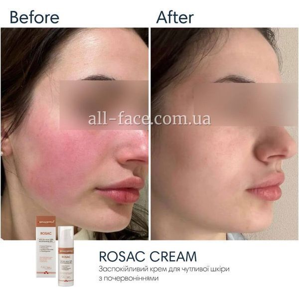 Крем з азелаїновою кислотою Braderm Rosac Cream, 30 мл 0420 фото
