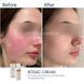 Крем з азелаїновою кислотою Braderm Rosac Cream, 30 мл 0420 фото 2