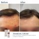 Крем проти пігментації Braderm Tramexal Cream, 30 мл 0423 фото 2