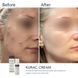 Нічний крем з бензоїл пероксидом Braderm Kurac Cream, 30мл 0424 фото 3