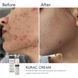Нічний крем з бензоїл пероксидом Braderm Kurac Cream, 30мл 0424 фото 2