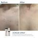 Спрей-концентрат для тіла з бензоїл пероксидом Braderm Dorsak Spray, 100 мл 0425 фото 2