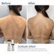 Спрей-концентрат для тіла з бензоїл пероксидом Braderm Dorsak Spray, 100 мл 0425 фото 4