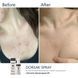 Спрей-концентрат для тіла з бензоїл пероксидом Braderm Dorsak Spray, 100 мл 0425 фото 3